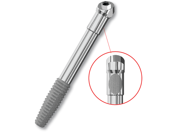 ZYGOMA Implants